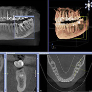 Diagnostik Bergheim Zahnarzt